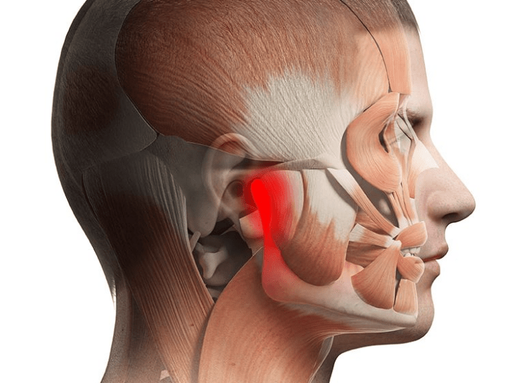 TMJ Problems